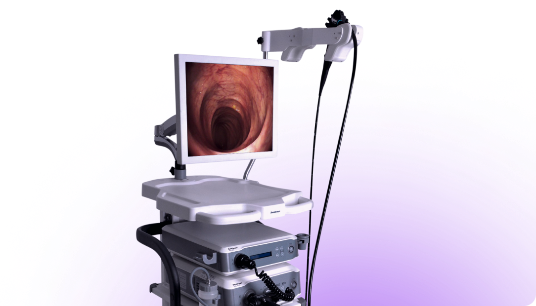 Эндоскопия